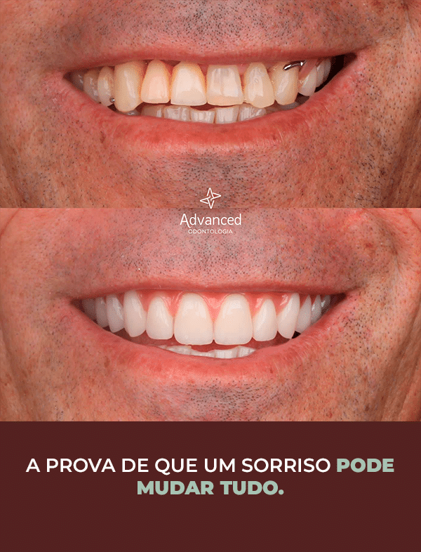 Prancheta 3 copiar 2