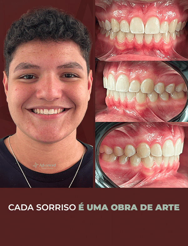 Prancheta 3 copiar 3